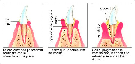 Fikadental periodoncia 
